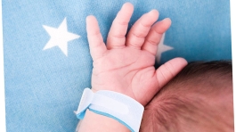 مچبند شناسایی بیمار TSC اطفال سفید