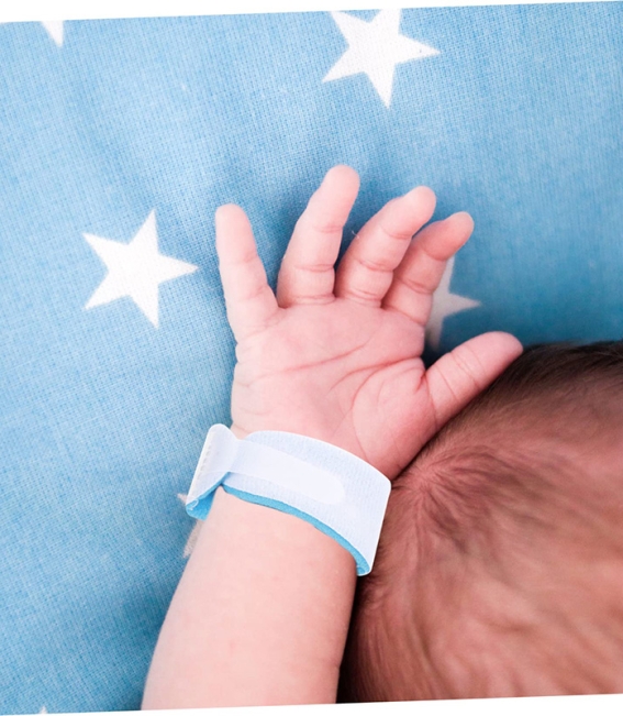 مچبند شناسایی بیمار TSC اطفال سفید